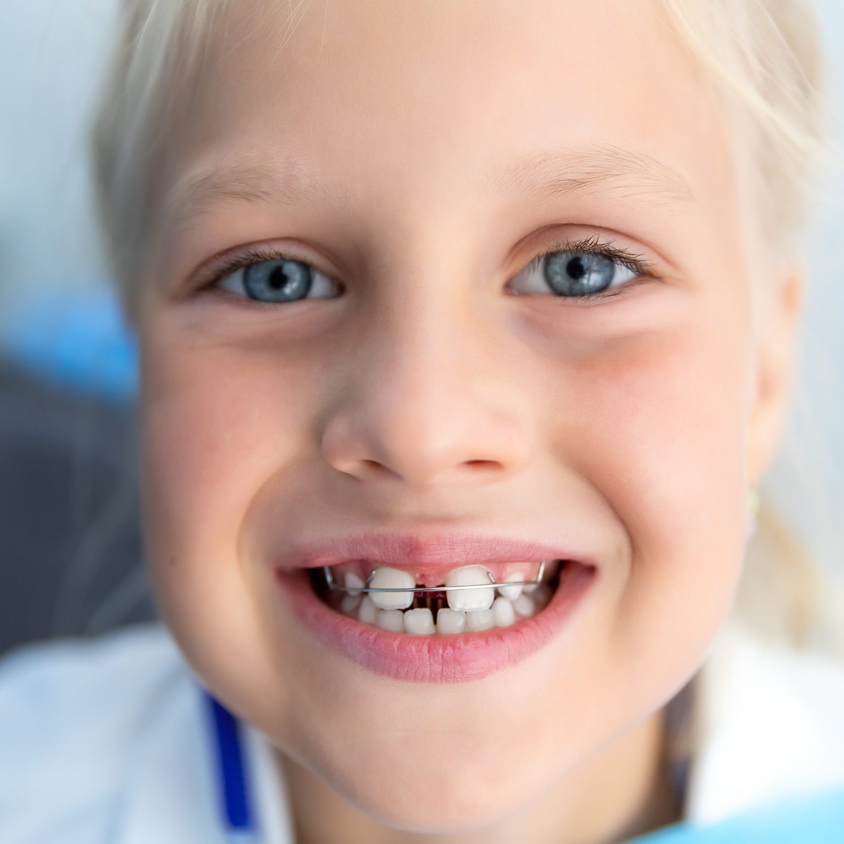 Little,Blond,Happy,Kid,Girl,At,Dentist,Office,Smiling,Showing